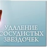 Удаление сосудистых звездочек