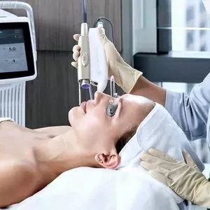 Фотоомоложение кожи.