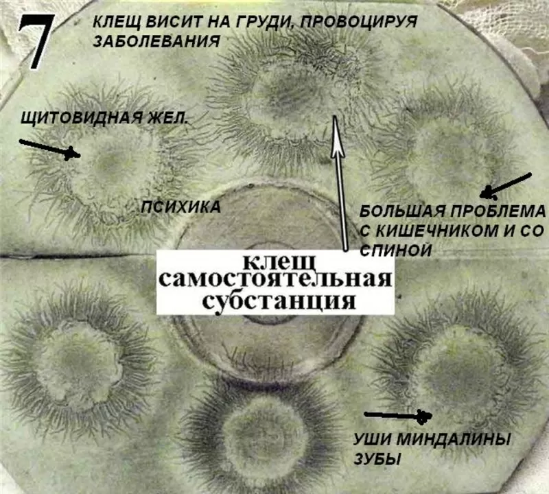  АУРА. Ауроскоп – простой прибор для самодиагностики по ауре за 25дол. 3